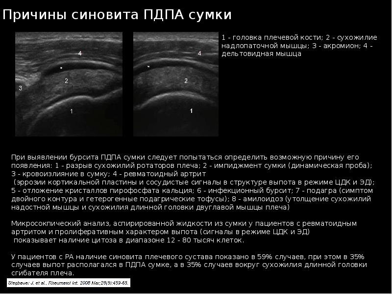 Узи суставов презентация