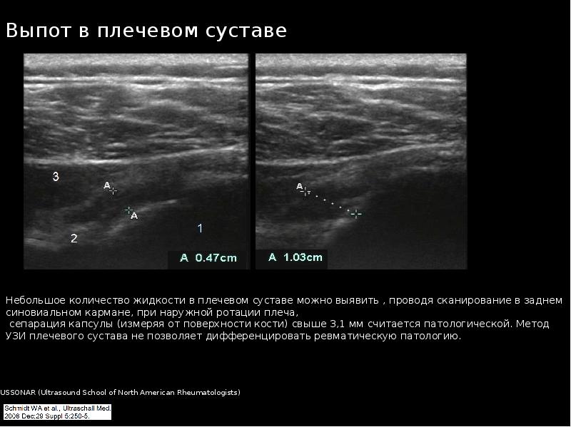 Узи суставов презентация