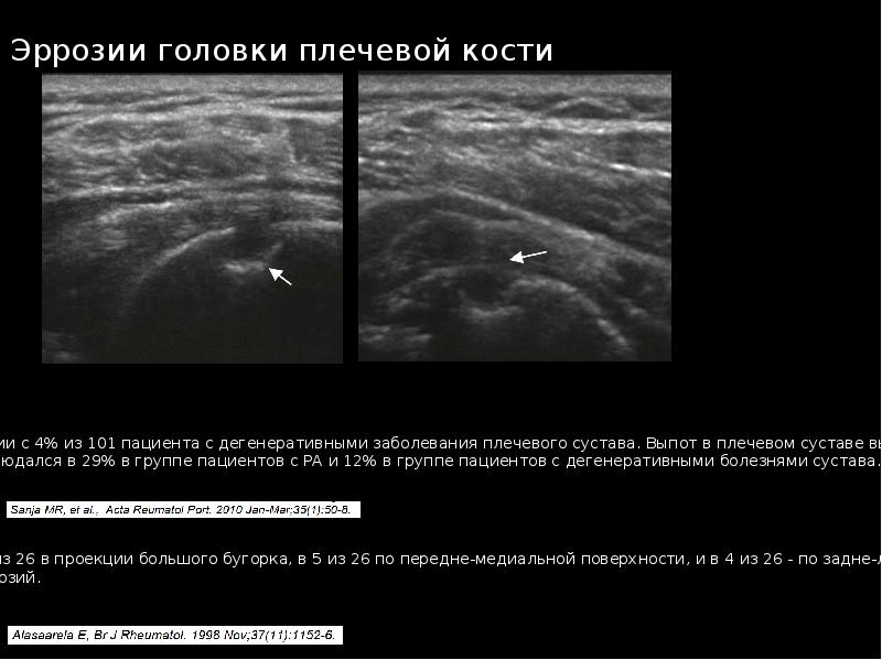 Узи суставов презентация