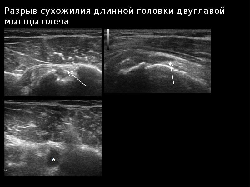 Узи суставов презентация