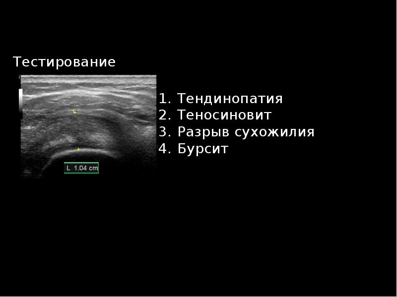 Узи суставов презентация