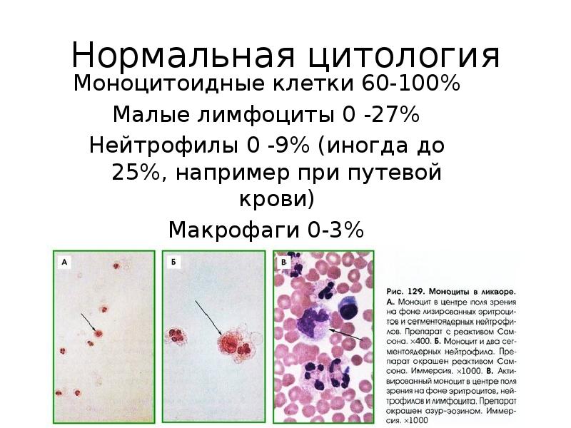 Спинномозговая жидкость презентация