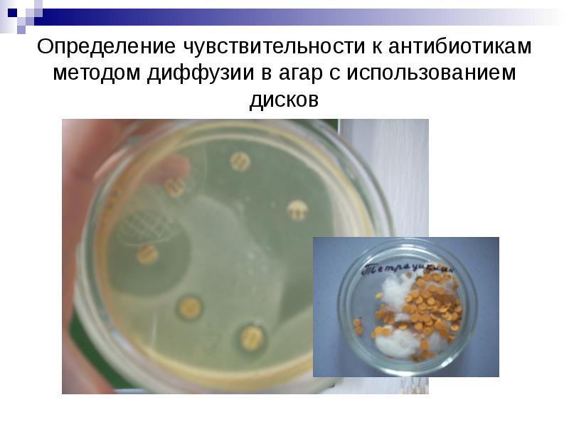 Возбудитель сибирской язвы микробиология презентация