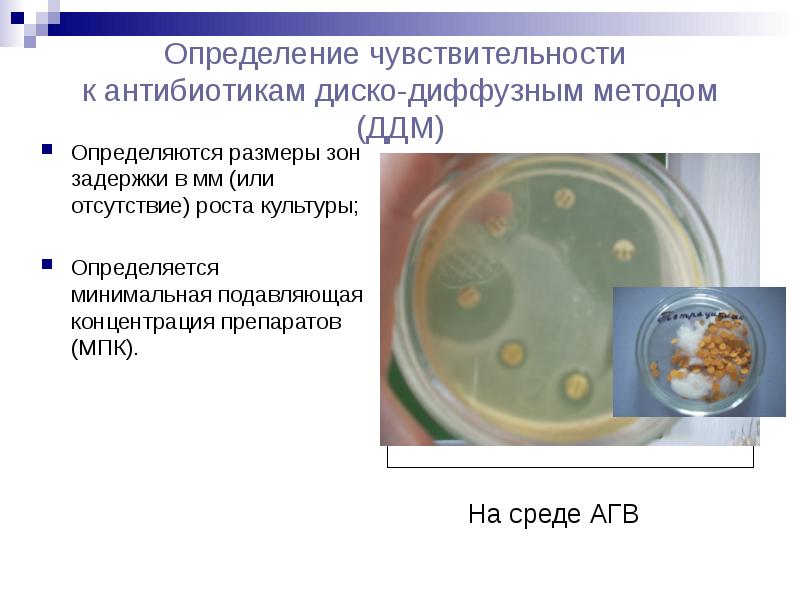 Возбудитель сибирской язвы микробиология презентация