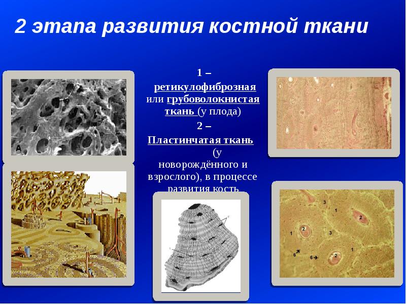 Исследование костной ткани. Костная ткань. Этапы формирования костной ткани. Костная ткань ткань. Костная ткань презентация.