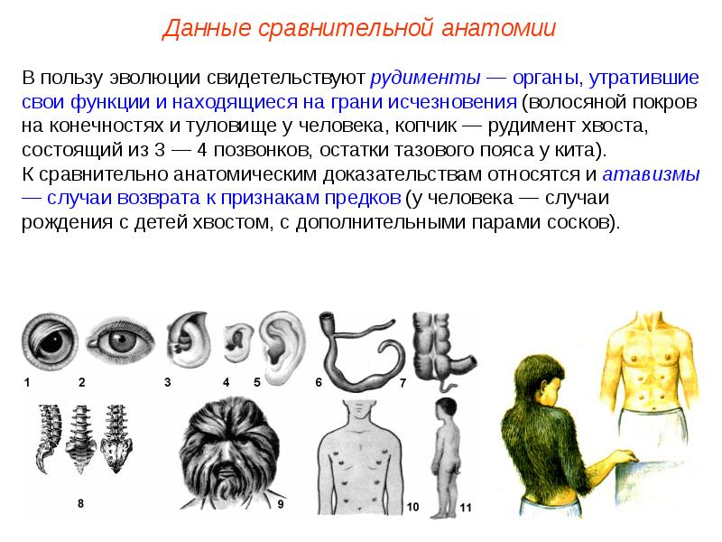 Презентация на тему рудименты и атавизмы