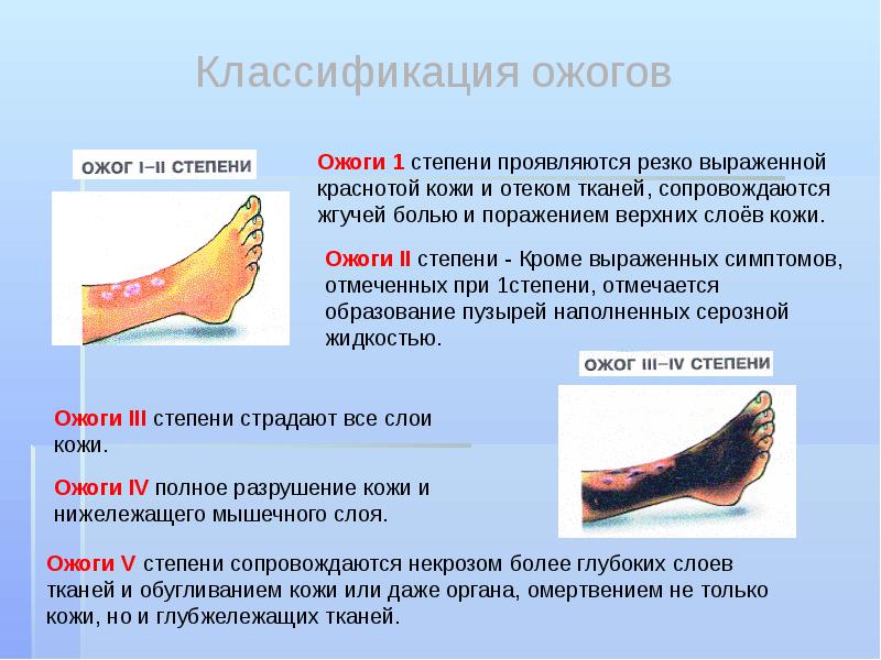 Презентация на тему солнечный и тепловой удар