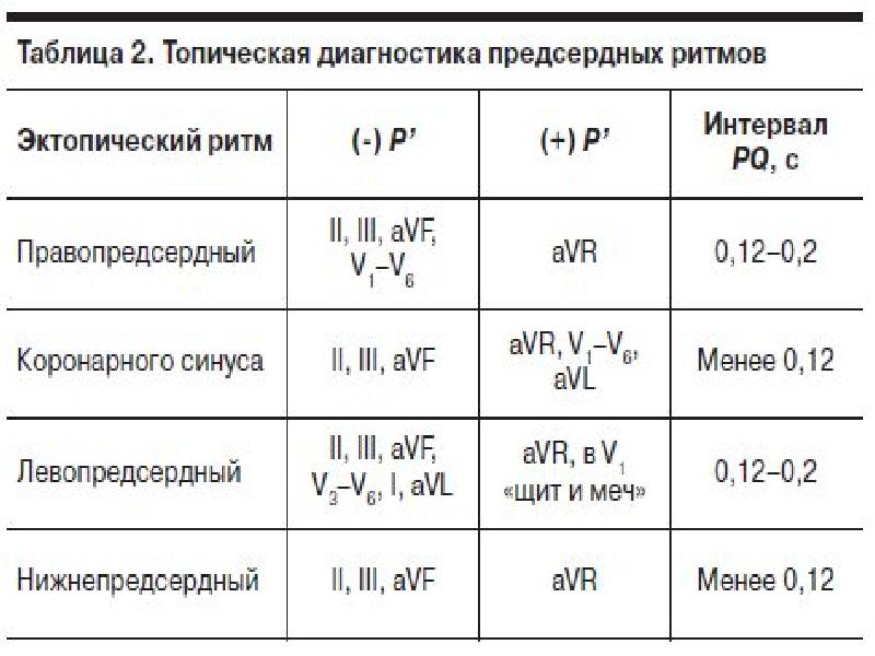 Синдром слабости синусового узла презентация