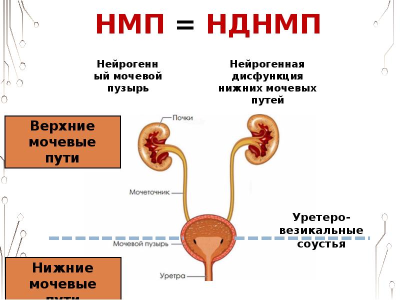 Нейрогенный мочевой пузырь мкб 10