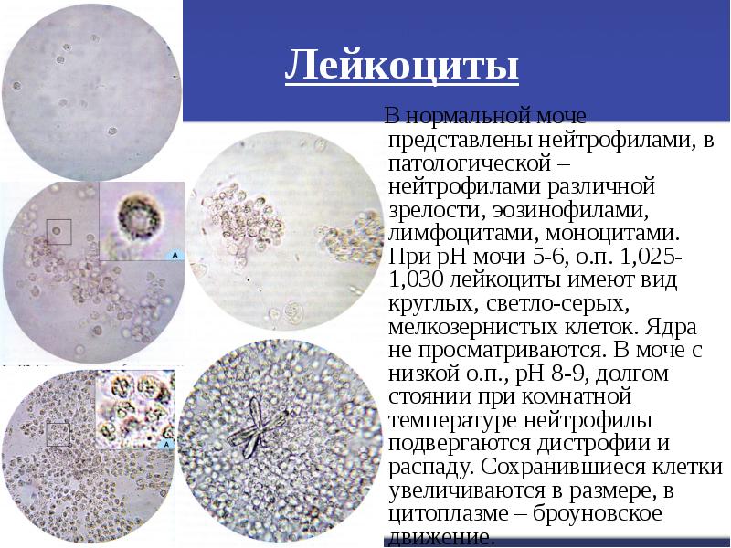 Микроскопия осадка мочи фото с описанием