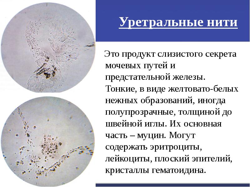 Организованный и неорганизованный осадок мочи презентация