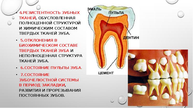 Классификация кариеса презентация