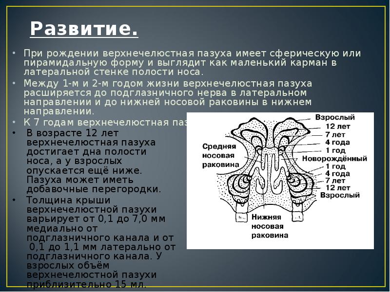 Анатомия верхнечелюстной пазухи презентация