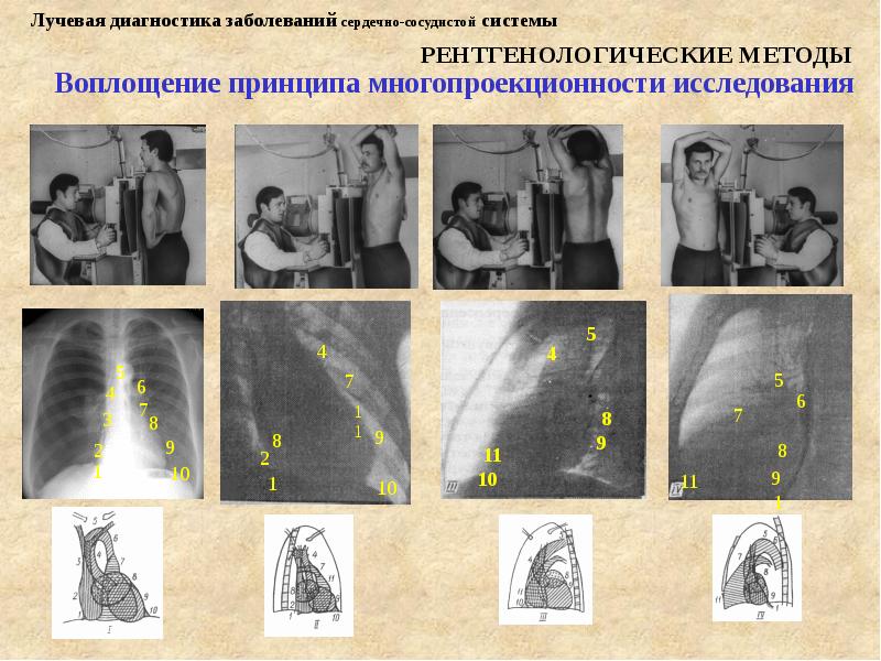Лучевая диагностика сердечно сосудистой системы презентация