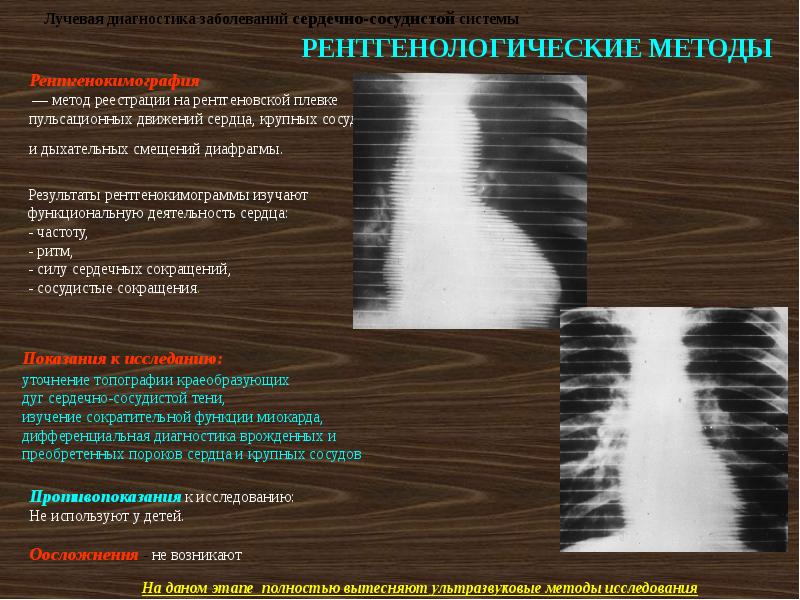 Лучевая диагностика сердечно сосудистой системы презентация