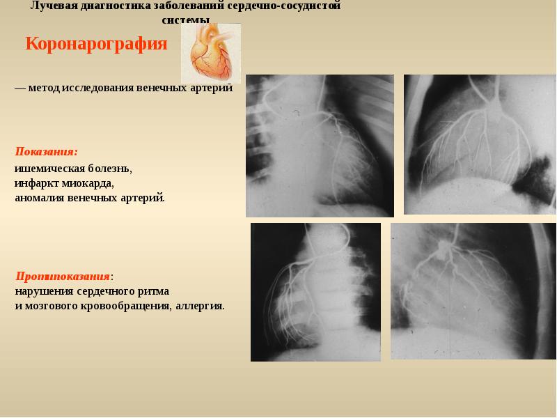 Лучевая диагностика сердечно сосудистой системы презентация