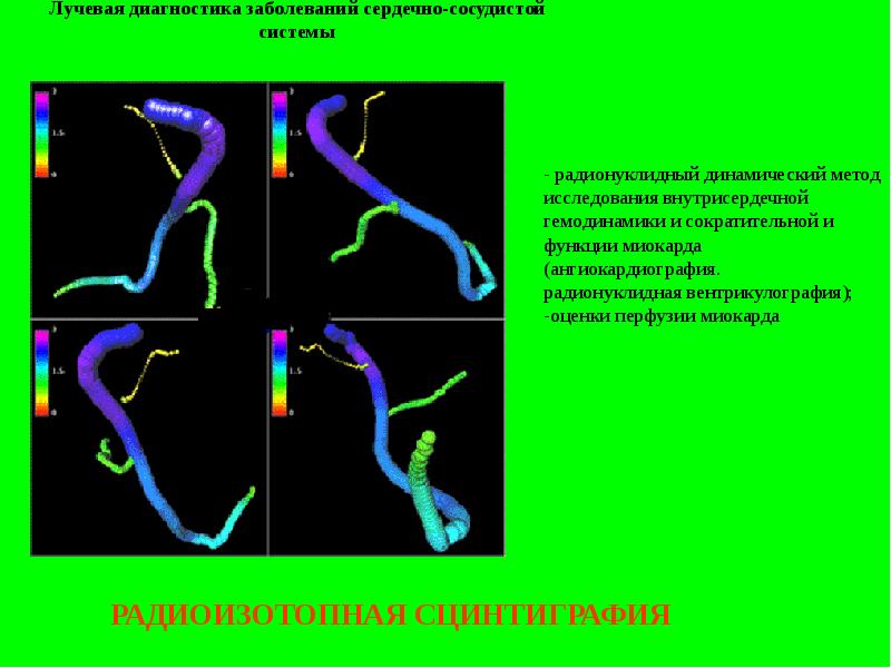 Лучевая диагностика сердечно сосудистой системы презентация