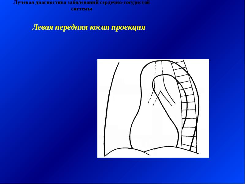 Лучевая диагностика сердечно сосудистой системы презентация