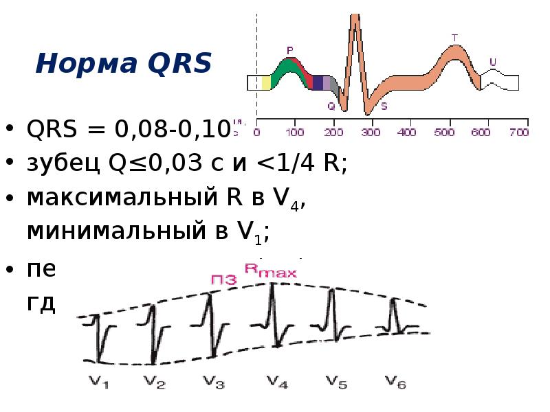 Переходная зона v3 что это на экг. Переходная зона v3 v4. Переходная зона v3 v4. Отведение v1 на экг норма. Переходная зона v3-v4 что это на экг.