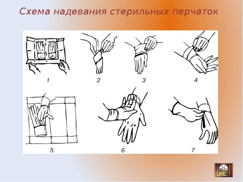 Схема одевание стерильных перчаток