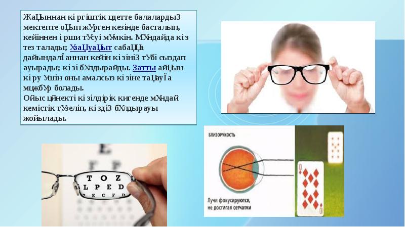 Көз оптикалық жүйе көздiң көру кемшіліктері және оларды түзету әдiстері презентация