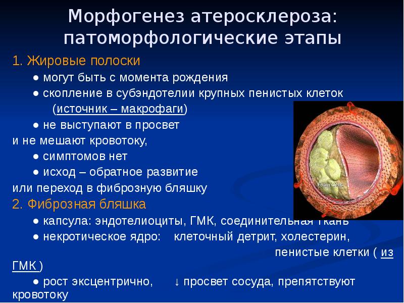 Патофизиология атеросклероза презентация