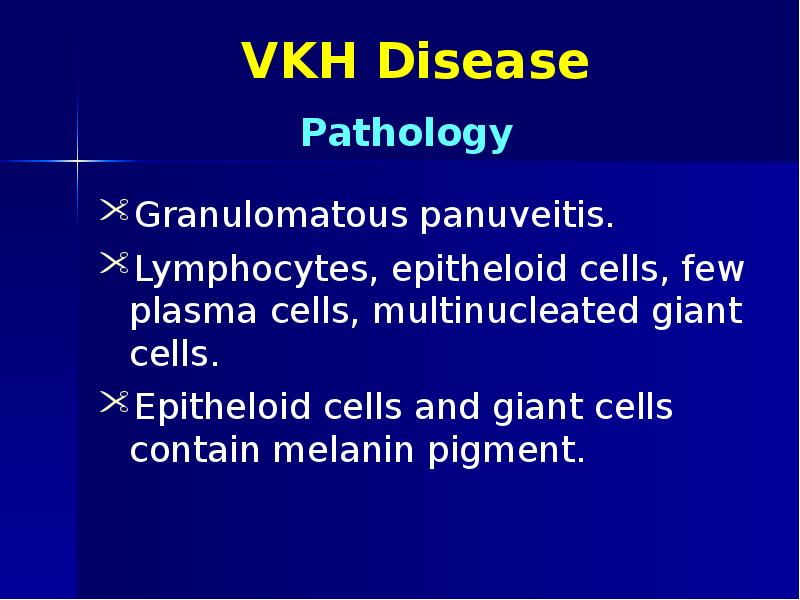 VKH Disease Granulomatous panuveitis. Lymphocytes, epitheloid cells, few plasma cells, multinucleated