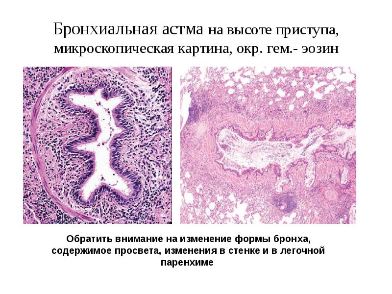 Микроскопическая картина u у мужчин