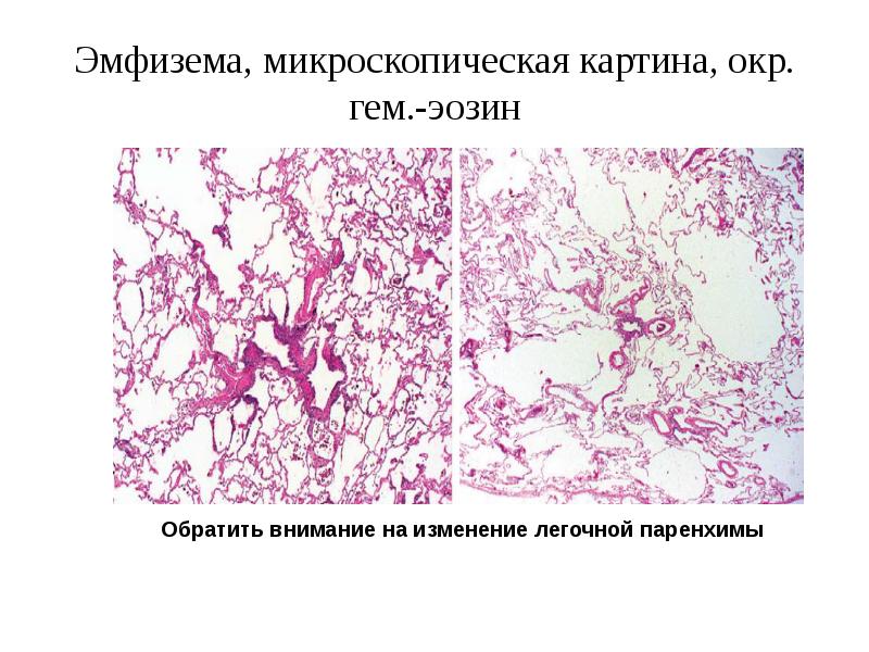 Микроскопическая картина