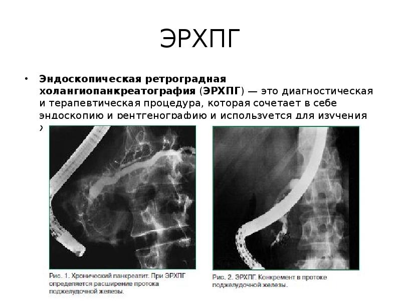 Узи хирургия презентация