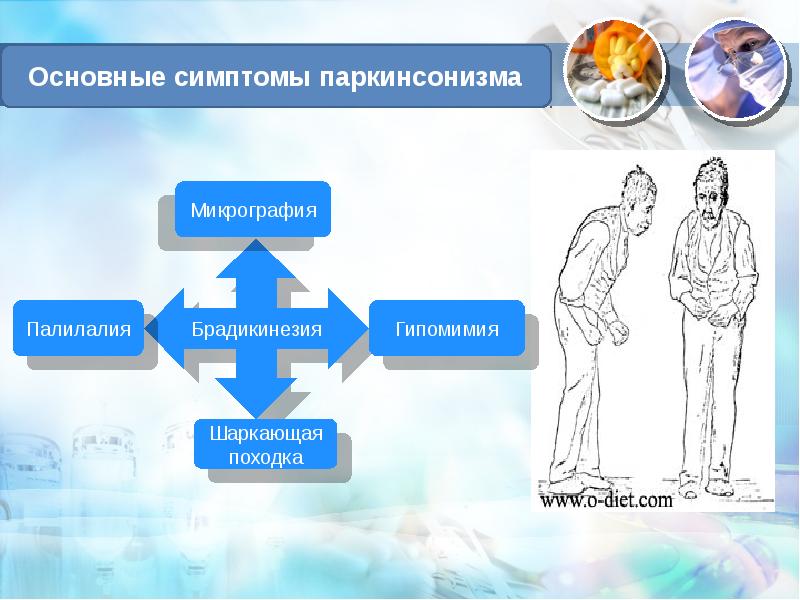 Презентация про болезнь паркинсона