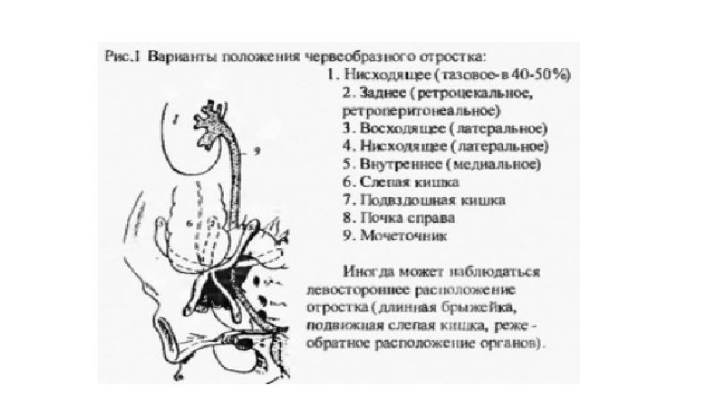 Острый живот в практике терапевта презентация