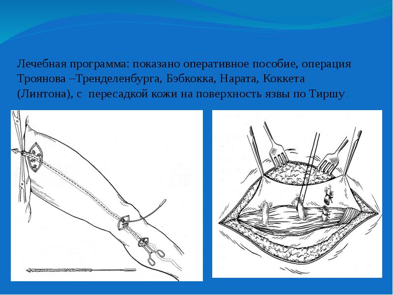 Операция троянова