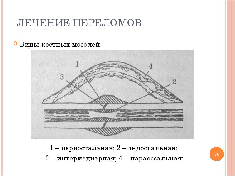 Физиотерапия в травматологии презентация