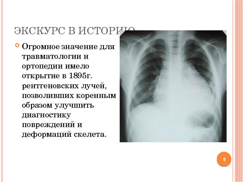 Физиотерапия в травматологии презентация