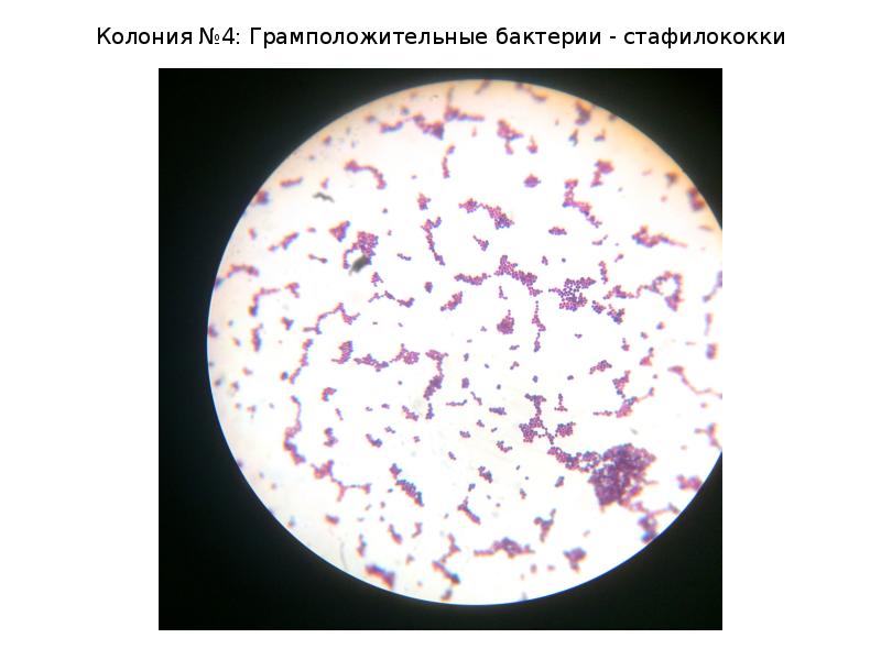 Gram positive and gram negative bacteria. Грамположительные бактерии список. Грамотрицательные бактерии кишечная палочка. Грамположительная микрофлора. Строение грамположительных и грамотрицательных бактерий.