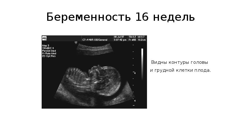 Изображение при узи получают в результате