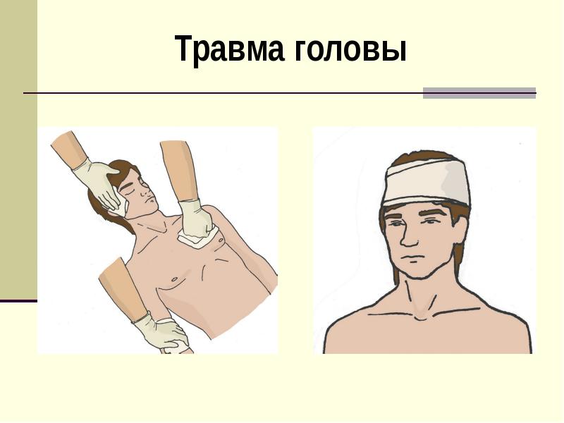 Алгоритм кровотечение и ранений. Травма головы алгоритм. травма головы с кровотечением. ушиб головы кровотечение.