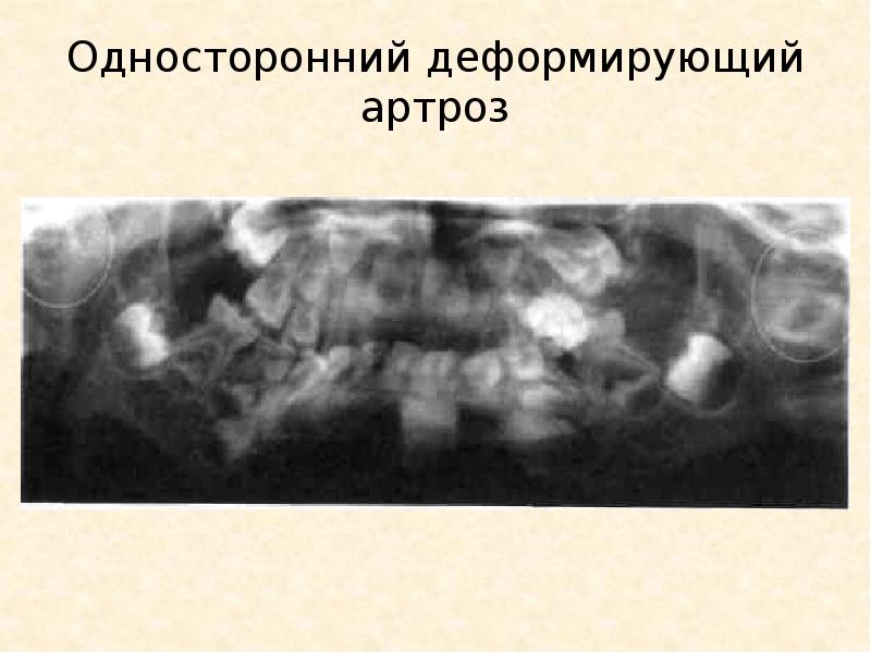 Лучевая диагностика внчс презентация