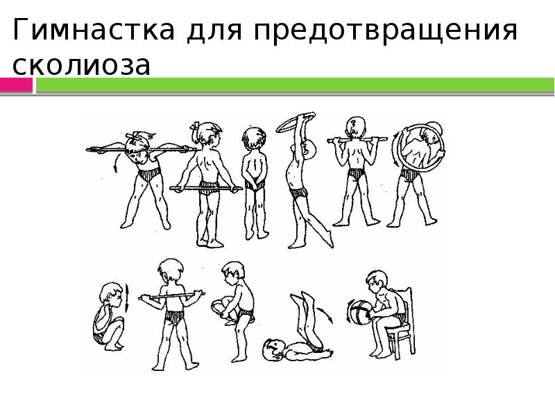 Профилактика сколиоза презентация