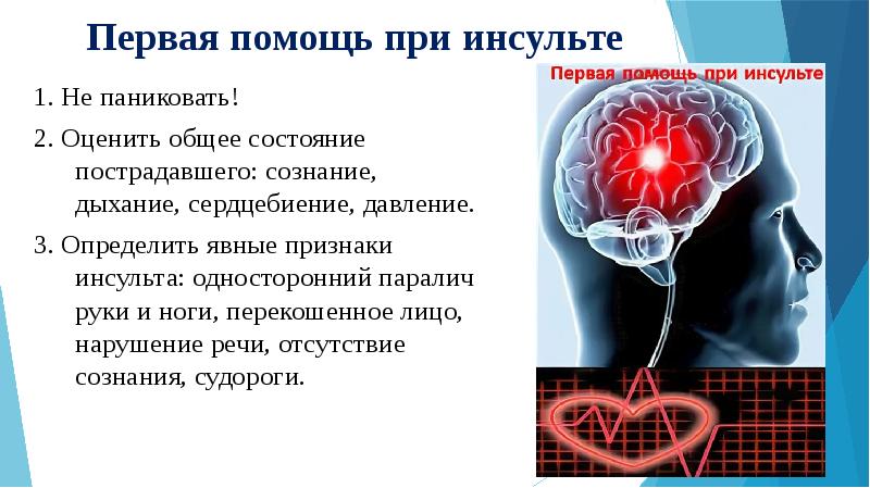 Презентация инсульт для школьников