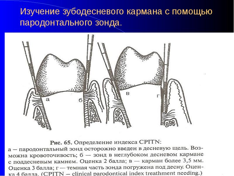 Первичная травматическая окклюзия презентация