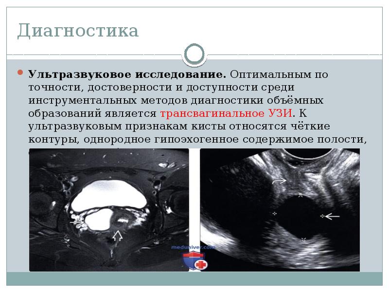 Диагностика
Ультразвуковое исследование. Оптимальным по точности, достоверности и доступности среди инструментальных методов Диагностика
Ультразвуковое исследование. Оптимальным по точности, достоверности и доступности среди инструментальных методов