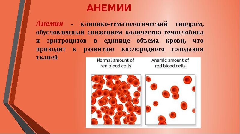 Презентация на тему сестринский уход при анемии