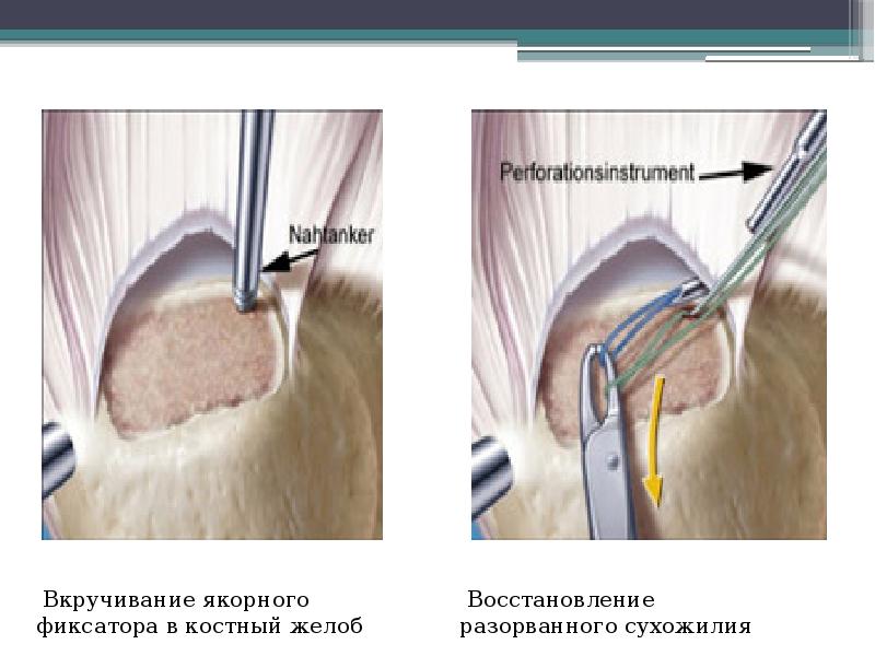 Восстановить поврежденную презентацию