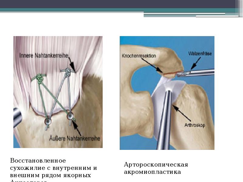 Восстановить поврежденную презентацию