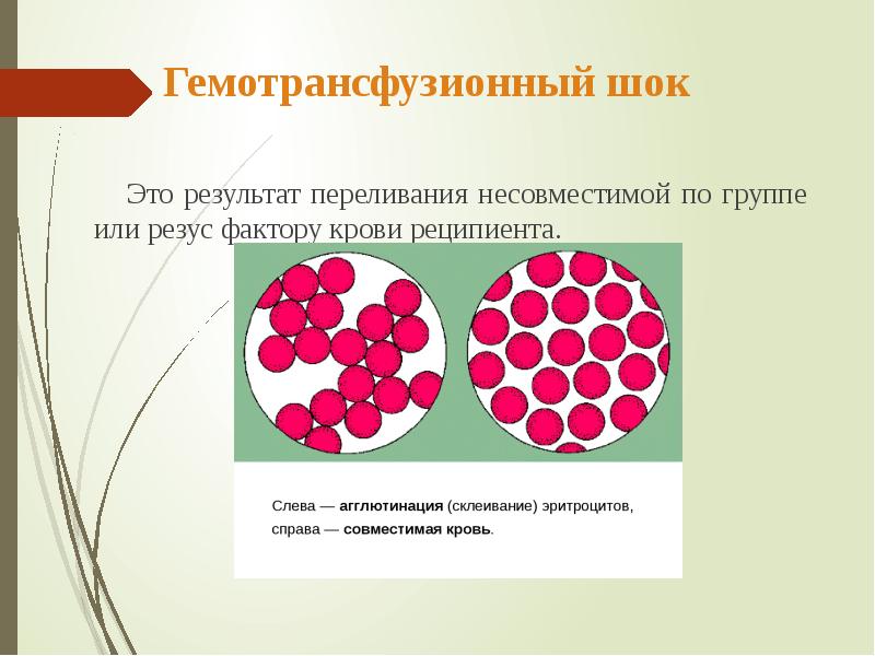 Гемотрансфузионный шок презентация