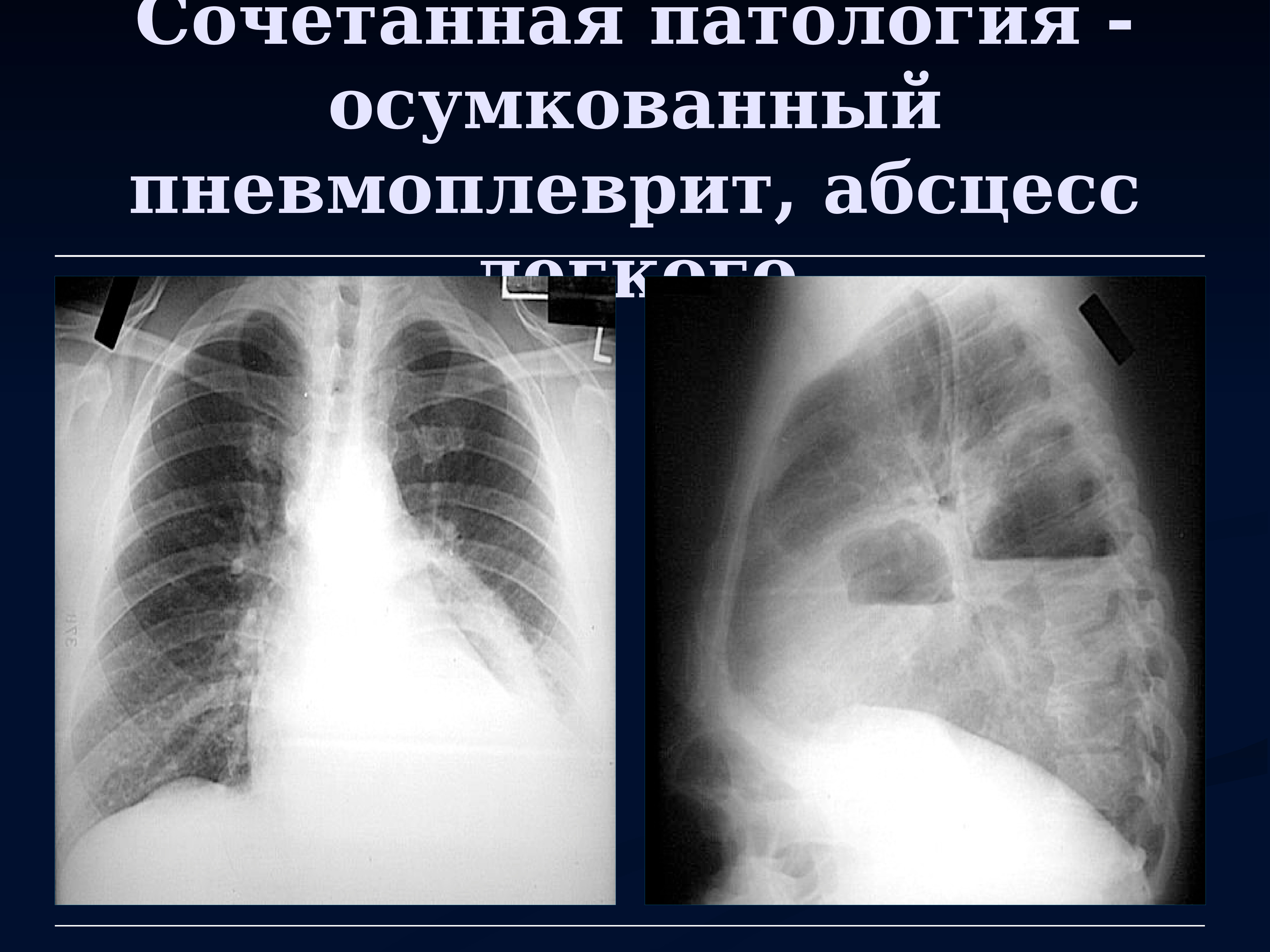 Лучевая диагностика органов дыхания презентация