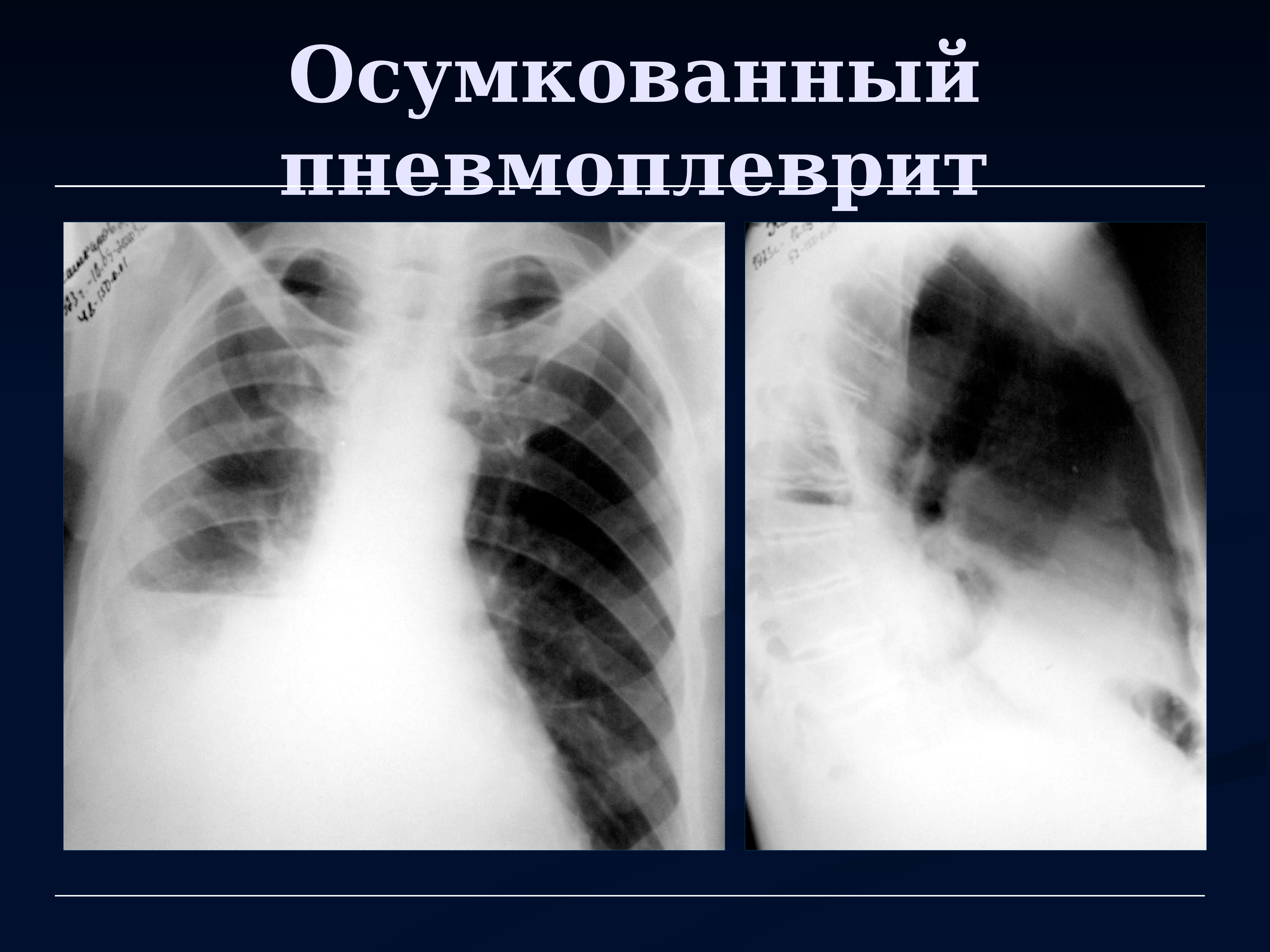 Лучевая диагностика органов дыхания презентация