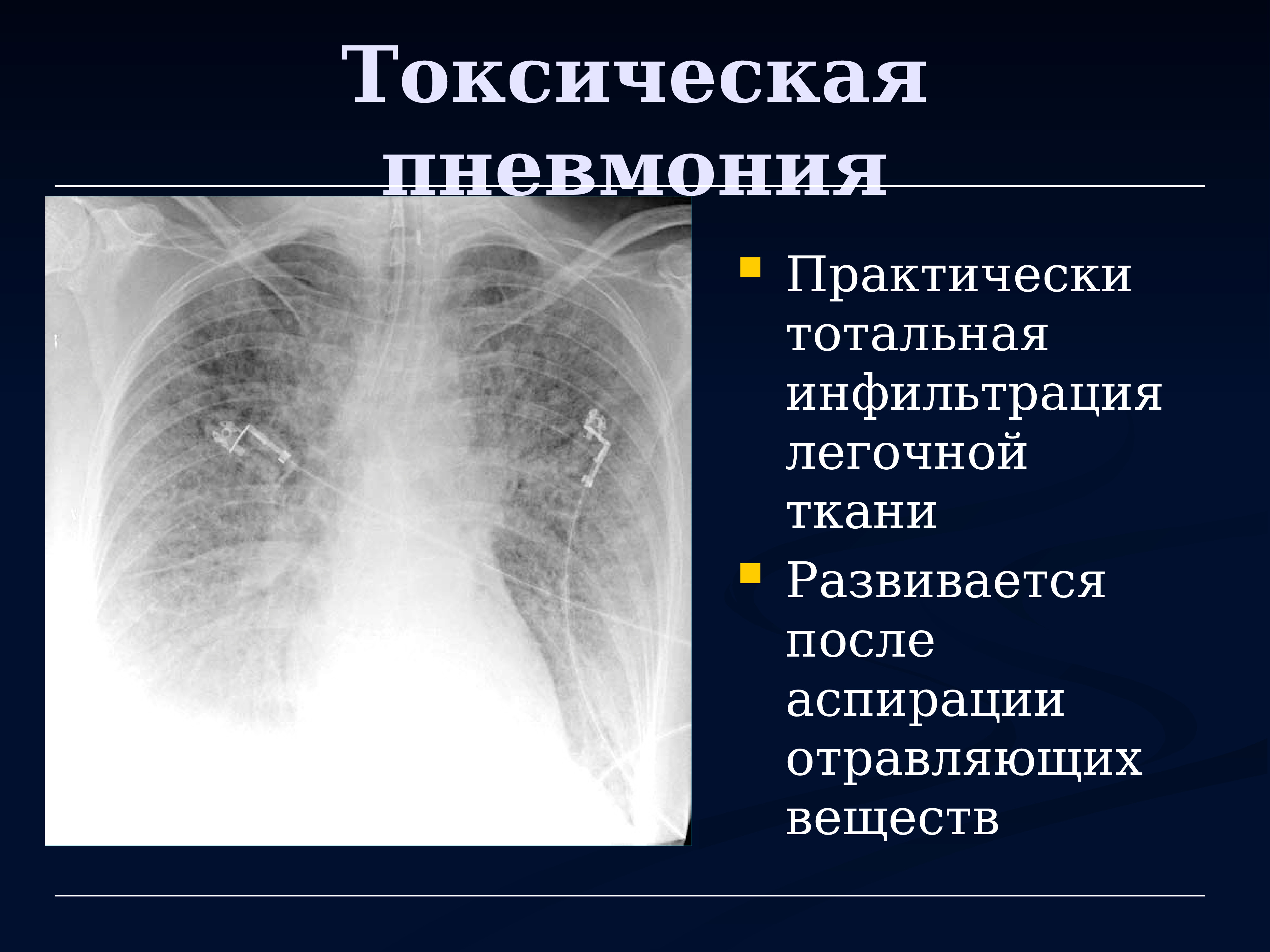 Лучевая диагностика органов дыхания презентация